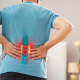 Hernia de disc
