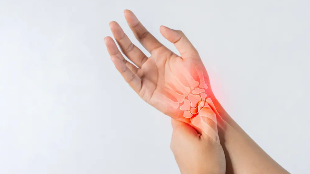 Sindromul de Tunel Carpian