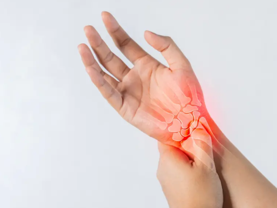 Sindromul de Tunel Carpian